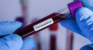 Espírito Santo registra 19 mortes e mais de mil casos do novo coronavírus em 24 horas