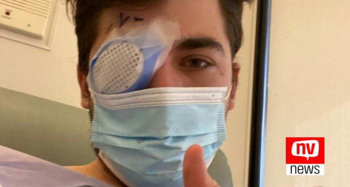 Jovem americano contrai parasita e perde a visão após dormir com lentes de contato